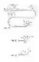 Fig. 02 - Long nose manipulatable catheter