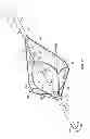 Fig. 06 - Multi-lumen central access vena cava filter apparatus and method of using same