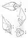 Fig. 07 - Multi-lumen central access vena cava filter apparatus and method of using same