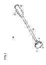 Fig. 02 - Device for closing luminal cavity and method therefor