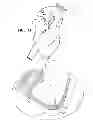 Fig. 07 - MINIMALLY INVASIVE SURGICAL TECHNIQUES