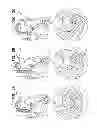 Fig. 09 - MINIMALLY INVASIVE SURGICAL TECHNIQUES