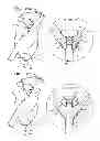 Fig. 22 - MINIMALLY INVASIVE SURGICAL TECHNIQUES