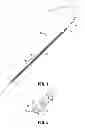 Fig. 02 - Wound closure device