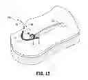 Fig. 06 - Wound closure device