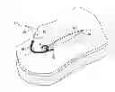Fig. 01 - Wound closure device