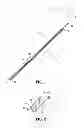 Fig. 02 - Wound closure device