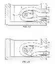 Fig. 02 - Restricted wedge suture anchor and method for soft tissue repair