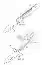 Fig. 07 - Restricted wedge suture anchor and method for soft tissue repair