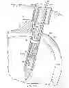 Fig. 09 - Restricted wedge suture anchor and method for soft tissue repair