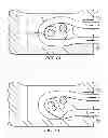 Fig. 02 - Method for soft tissue repair with free floating suture locking member