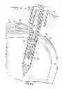 Fig. 08 - Method for soft tissue repair with free floating suture locking member