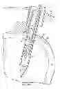 Fig. 09 - Method for soft tissue repair with free floating suture locking member