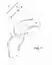 Fig. 04 - Tissue graft anchoring