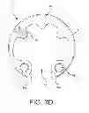 Fig. 07 - Spinal anchoring screw