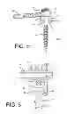 Fig. 09 - Spinal anchoring screw