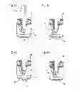 Fig. 08 - Bone anchoring device