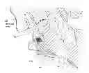 Fig. 01 - DEVICE AND METHOD TO ACCESS THE ANTERIOR COLUMN OF THE SPINE