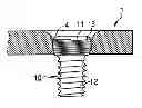 Fig. 01 - Bone plate