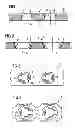 Fig. 02 - Bone plate