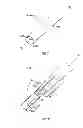 Fig. 06 - Surgical fastener with predetermined resorption rate