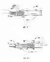 Fig. 09 - Surgical fastener with predetermined resorption rate