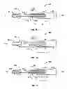 Fig. 10 - Surgical fastener with predetermined resorption rate