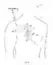 Fig. 02 - PRIORITIZED PROGRAMMING OF MULTI-ELECTRODE PACING LEADS