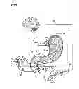 Fig. 03 - Electrode band system and methods of using the system to treat obesity