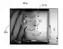 Fig. 01 - Medical electrical lead