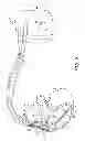 Fig. 03 - Medical electrical lead