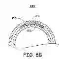 Fig. 09 - Medical electrical lead