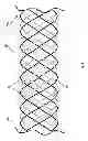 Fig. 02 - Non-woven helical wire stent