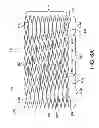 Fig. 09 - Stent