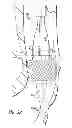 Fig. 22 - Inversion delivery device and method for a prosthesis