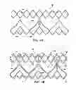 Fig. 08 - DURABLE MULTI-LAYER HIGH STRENGTH POLYMER COMPOSITE SUITABLE FOR IMPLANT AND ARTICLES PRODUCED THEREFROM