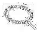 Fig. 01 - Adjustment suture markers for adjustable annuloplasty ring