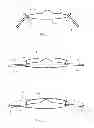 Fig. 04 - Accommodating intraocular lens
