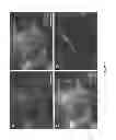 Fig. 08 - Methods for making a tissue engineered muscle repair (TEMR) construct in vitro for implantation in vivo