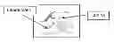 Fig. 01 - Laminoplasty implant, method and instrumentation