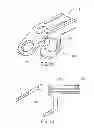 Fig. 06 - Laminoplasty implant, method and instrumentation