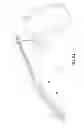 Fig. 08 - Laminoplasty implant, method and instrumentation