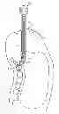 Fig. 01 - Method and system for performing spinal surgical procedures using natural orifices