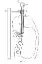 Fig. 06 - Method and system for performing spinal surgical procedures using natural orifices