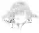 Fig. 01 - Systems and methods for facet joint treatment