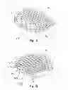 Fig. 07 - Systems and methods for facet joint treatment