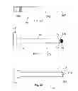 Fig. 10 - Systems and methods for facet joint treatment