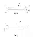Fig. 11 - Systems and methods for facet joint treatment