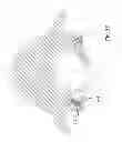 Fig. 15 - Systems and methods for facet joint treatment