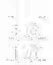 Fig. 07 - Vertebral facet joint prosthesis and method of fixation